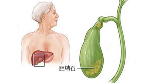 ������͵�Ӱ�� ���ڲ��������ʲôӰ��